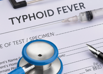 Typhoid fever