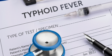 Typhoid fever