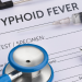 Typhoid fever