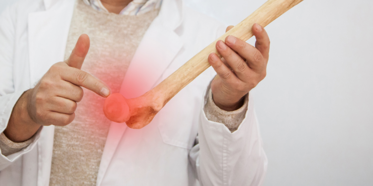 Bone density