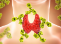 Thyroid