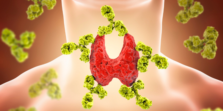 Thyroid