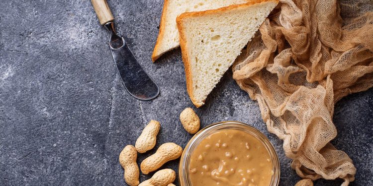 Food Allergy