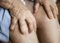 Gout Pain