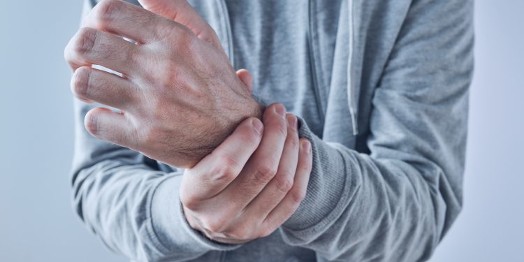 Rheumatoid Arthritis