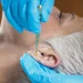 Bell’s palsy: Ringing relief through holistic ways