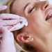 Crow’s Feet: The Natural way to Clear them