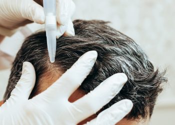 Scalp care tips and tricks