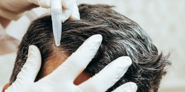 Scalp care tips and tricks