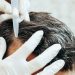 Scalp care tips and tricks