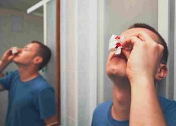 Understanding Nosebleeds Causes, Remedies, and Prevention