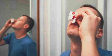 Understanding Nosebleeds Causes, Remedies, and Prevention