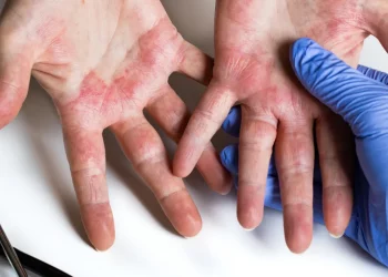 Understanding-Inflammation-and-Disease