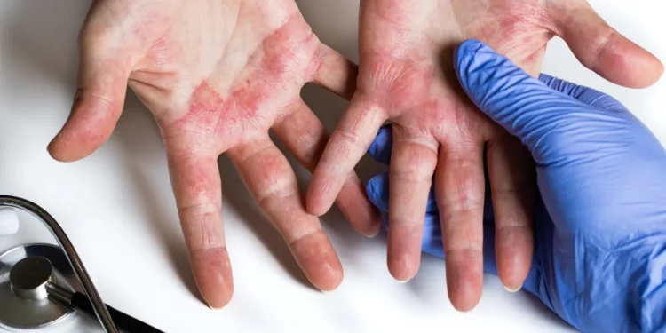 Understanding-Inflammation-and-Disease