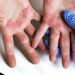 Understanding-Inflammation-and-Disease